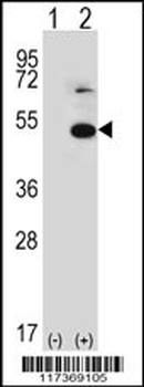 TRIP13 Antibody (N-term)