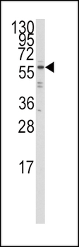 IRF5 Antibody (N-term)