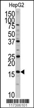 XTP3TPA Antibody (N-term)