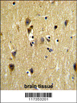 STIP1 Antibody (Center)