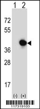 RFC5 Antibody (Center R185)