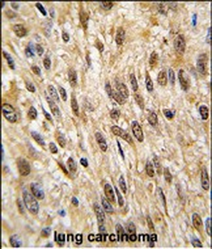 PTPN6 Antibody (Center)