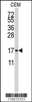 S100A11 Antibody (S6)
