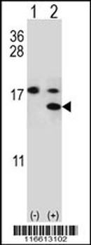S100A11 Antibody (S6)