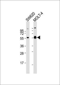 RUNX1 Antibody (S276)