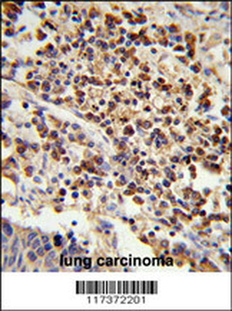 U2AF1 Antibody (Center Y114)