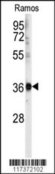 U2AF1 Antibody (Center Y114)
