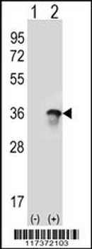U2AF1 Antibody (Center Y114)