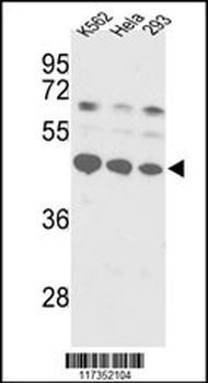 SSB Antibody (C-term)