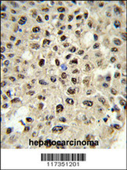 SSB Antibody (N-term)