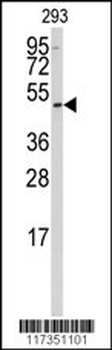 SSB Antibody (N-term)