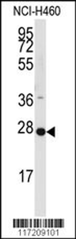 PPAP2C Antibody (C-term)