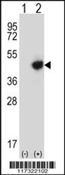RMND5B Antibody (C-term)