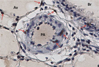 RFC2 Antibody (N-term)