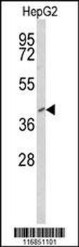 FOXP3 Antibody (Center)