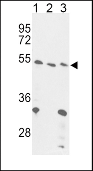 FOXP3 Antibody (C-term)