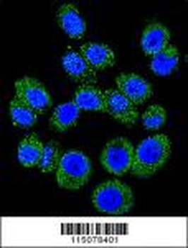 M6PR Antibody (C-term)