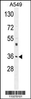 M6PR Antibody (C-term)
