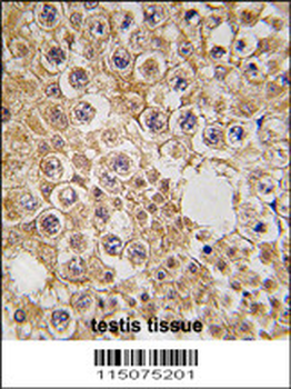 M6PR Antibody (N-term)