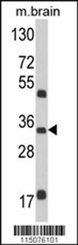 M6PR Antibody (N-term)