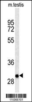 ITGB1BP3 Antibody (Center)
