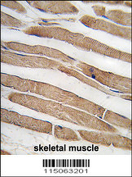 ITGB1BP3 Antibody (N-term)