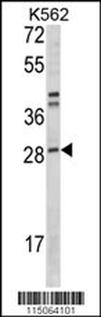 ITGB1BP3 Antibody (N-term)