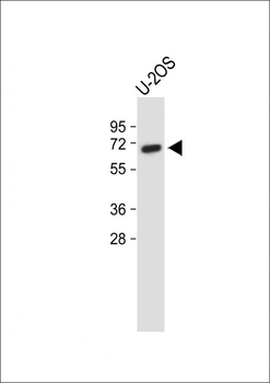 GPC4 Antibody (Center)