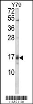 GADD45A Antibody (C-term)