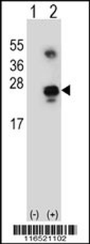 GADD45A Antibody (C-term)