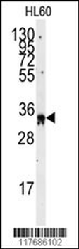 EXOSC8 Antibody (C-term)