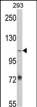 AASS Antibody (Center)