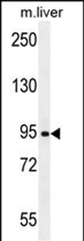 AASS Antibody (Center)