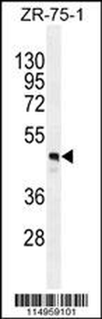 FUT4 Antibody (Center)
