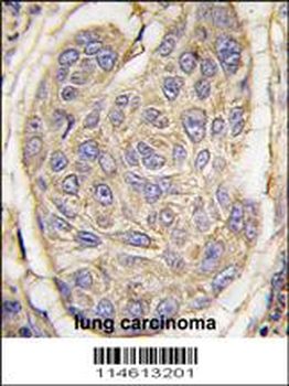 B2M Antibody (C-term)
