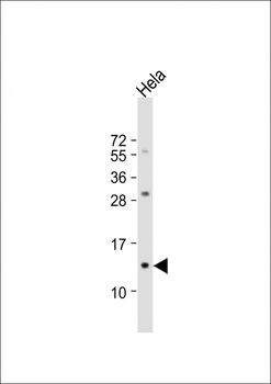 B2M Antibody (N-term)