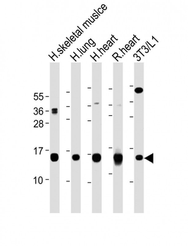 FABP4 Antibody (Y20)