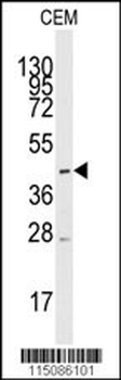MCT1 (SLC16A1) Antibody (Center)