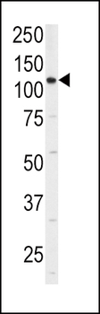 ITGA6 Antibody (isoform 2 S1064)