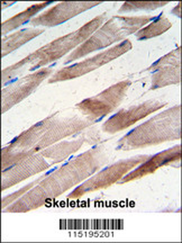 Desmin Antibody (T16)