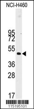 Desmin Antibody (T16)