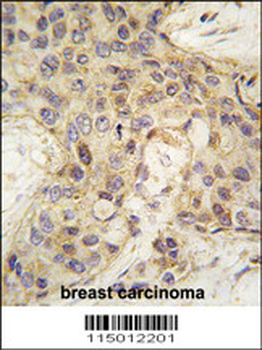 ANGEL2 Antibody (Center)