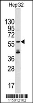 ANGEL2 Antibody (Center)