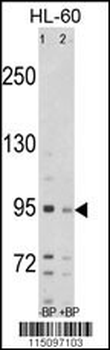 SEMA6A Antibody (C-term)