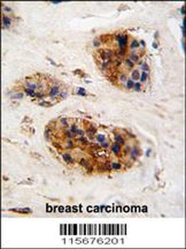 Vimentin Antibody (Center)