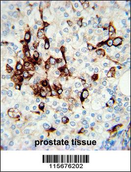 Vimentin Antibody (Center)