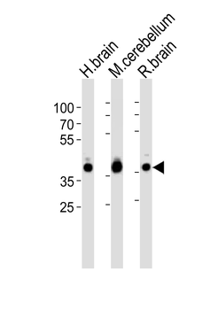 ALDOC Antibody (C-term)
