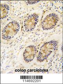 AKR1B1 Antibody (C-term)