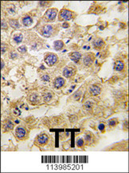 NANOS2 Antibody (C-term)