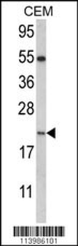 NANOS2 Antibody (C-term)